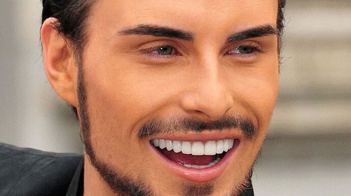 Rylan-Clark-teeth-after-picture_940x526